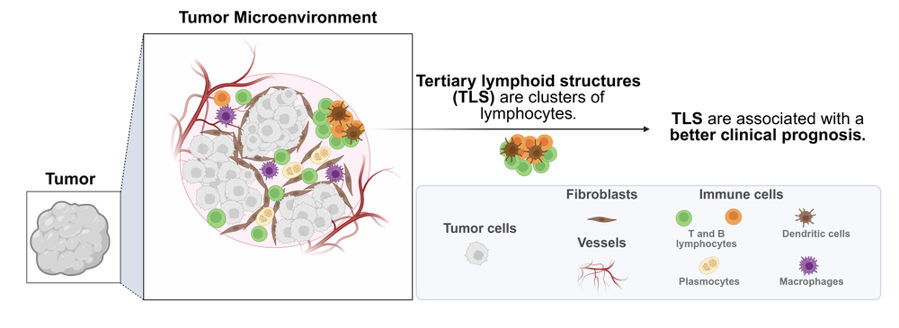 Diagram of the tumour microenvironment and the cells composing it, labelled in English.